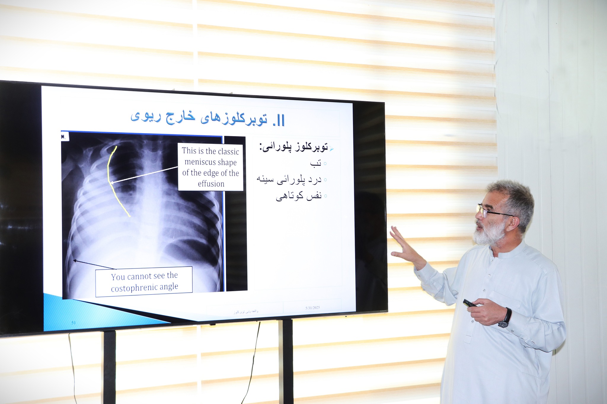 AFB Sputum Smear Microscopy Initial Training Conducted